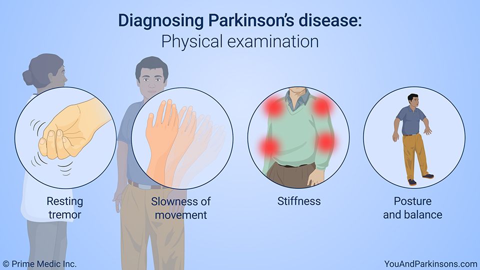 File:USE diagnosis Parkinsons Disease.jpeg